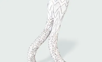 大動脈領域 エクスクルーダー