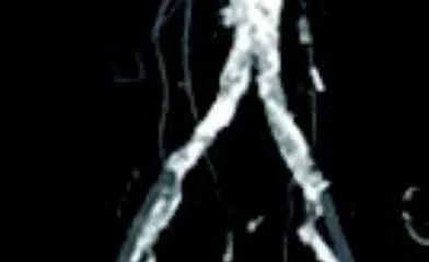 図1 術前コンピューター断層撮影（CT） 