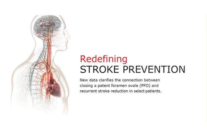 Presentation title slide with transparent upper body illustration