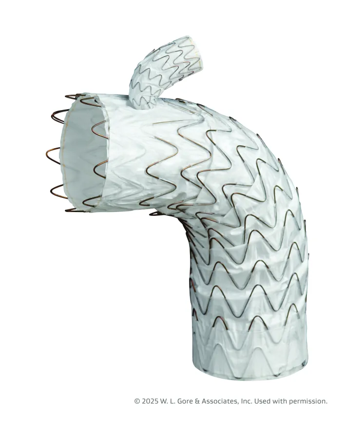 Thoracic Branch Endoprosthesis