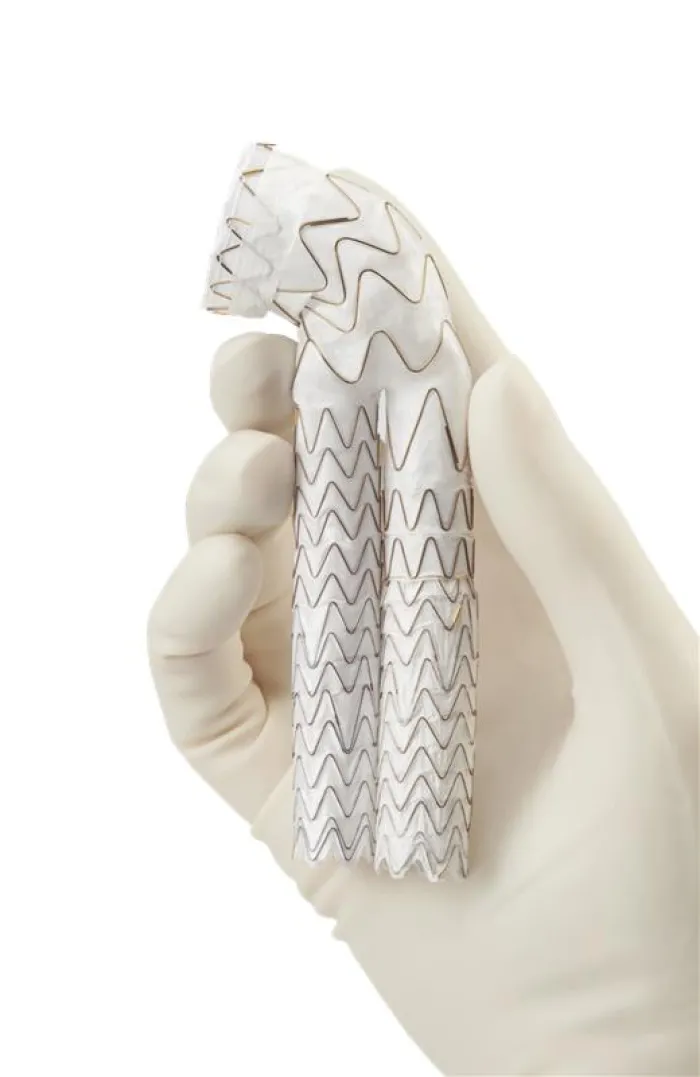 エクスクルーダー コンフォーマブル ステントグラフト 中枢側ネック角が90度までの症例にも使用可能