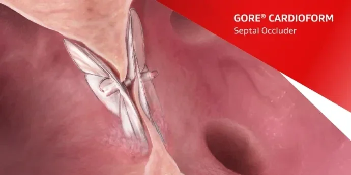 GORE® CARDIOFROM Septal Occluder