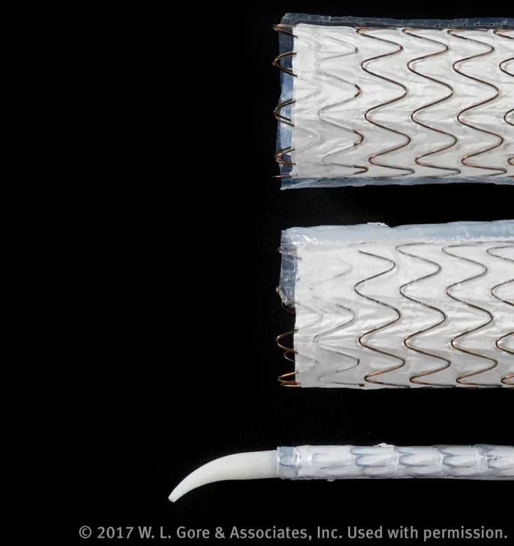 The device is constrained within two sleeves, which stay in place and are “sandwiched” between the stent graft and the aortic wall at the outer curve after deployment. The precurved olive is designed to enable self-orientation of the device toward the outer aortic curve.