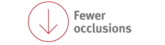 Fewer occlusions