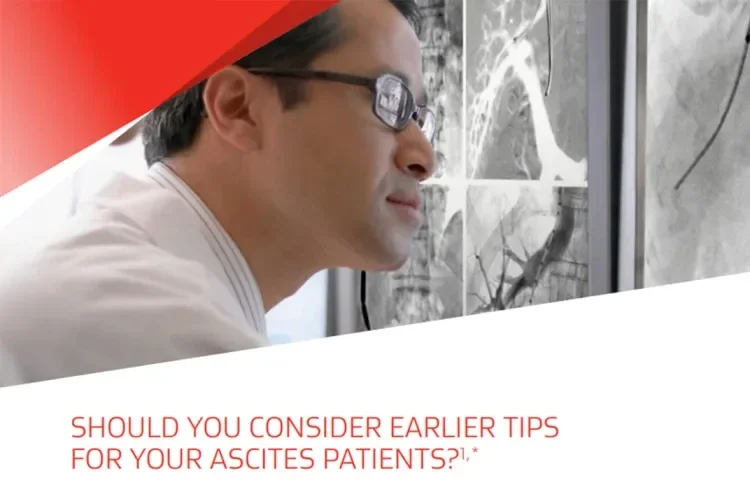 Should you consider earlier TIPS for your ascites patients?