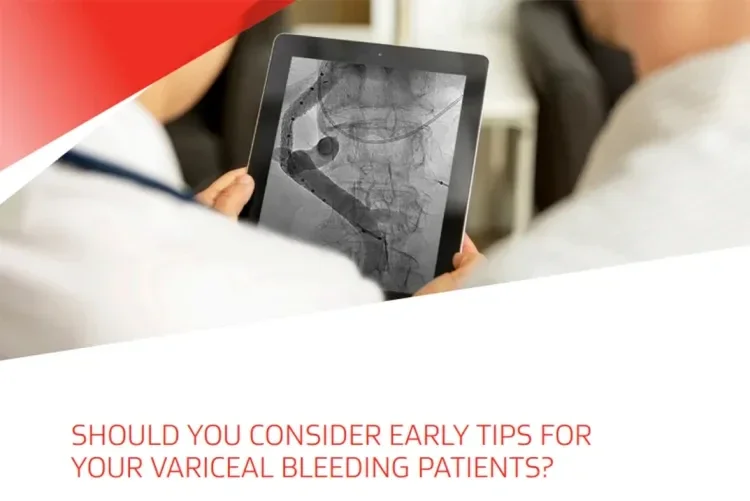 Should you consider earlier TIPS for your variceal bleeding patients?