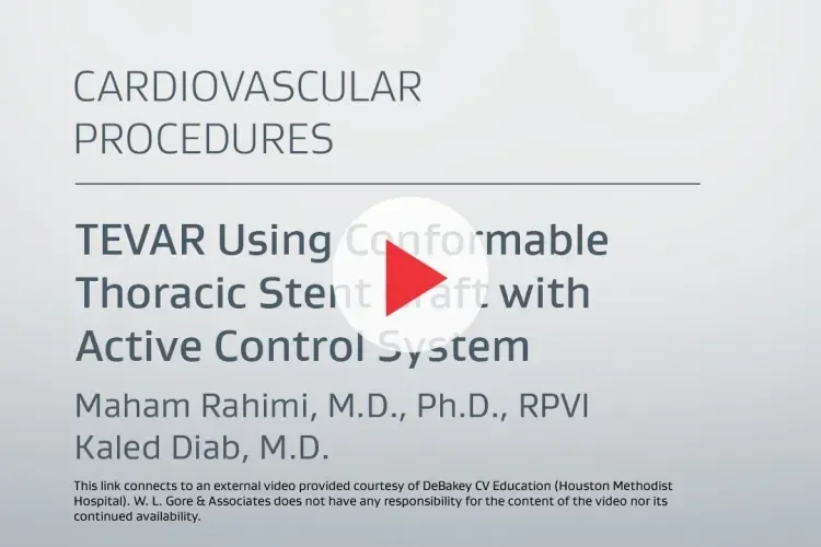 TEVAR Using Conformable Thoracic Stent Graft with Active Control System