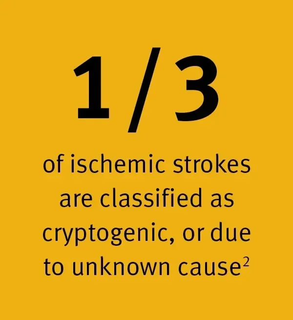 1/3 of ischemic strokes are classified as cryptogenic, or due to unknown cause