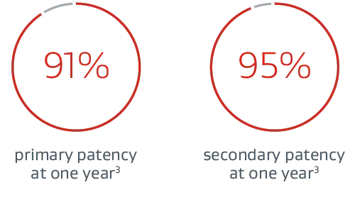 91% primary patency at one year. 95% secondary patency at one year