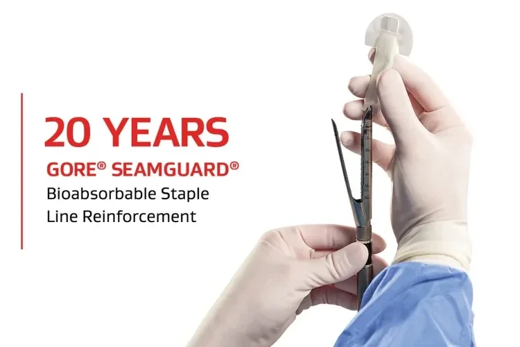 20 YEARS GORE SEAMGUARD Bioabsorbable Staple Line Reinforcement