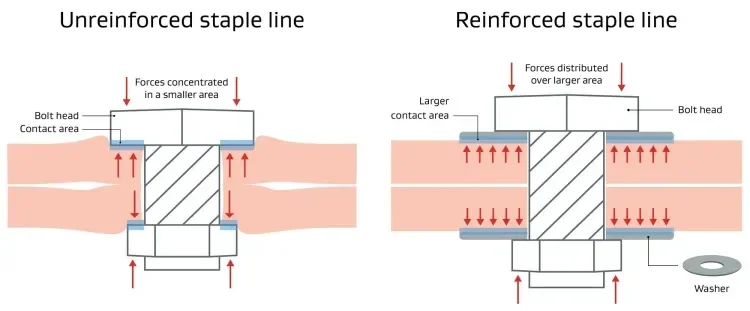 Reinforced and unreinforced staple lines