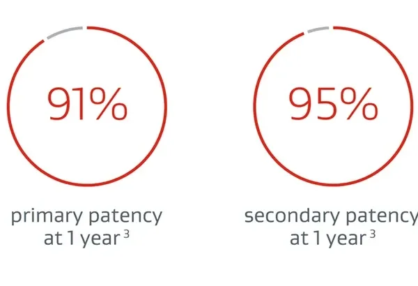 91% primary patency at one year. 95% secondary patency at one year