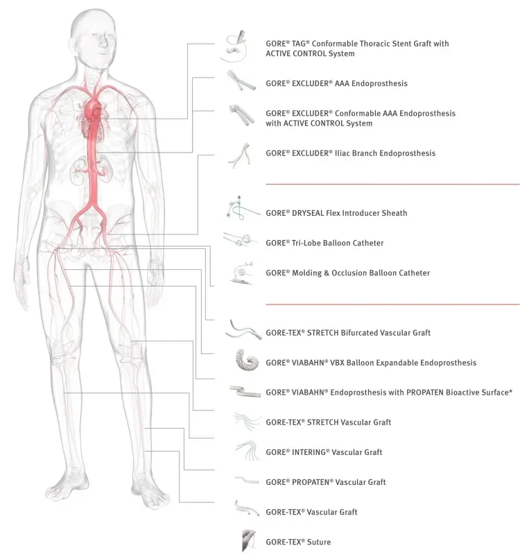 transparent man that illustrates where Gore Medical products are in the body