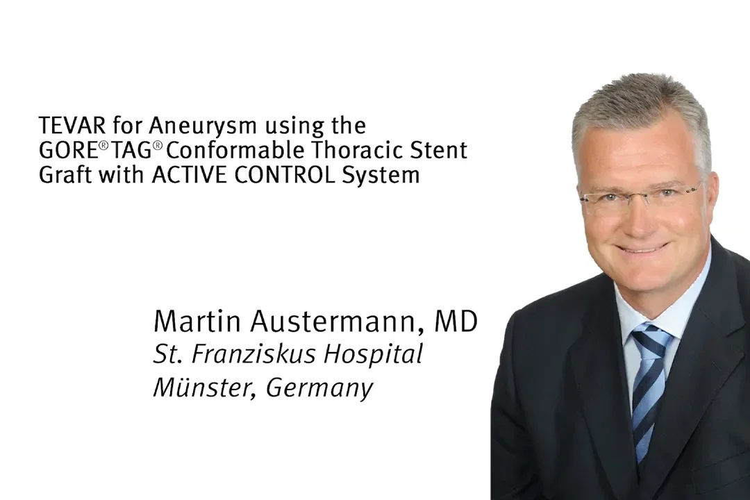 Dr Austermann Live Case #1 - Conformable GORE® TAG® Thoracic Stent Graft with ACTIVE CONTROL System