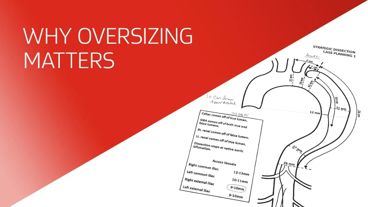 Why oversizing matters video thumbnail