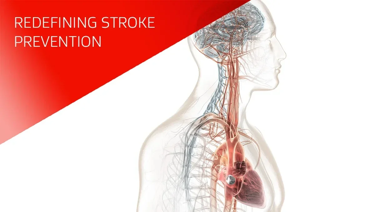 Redefining stroke prevention