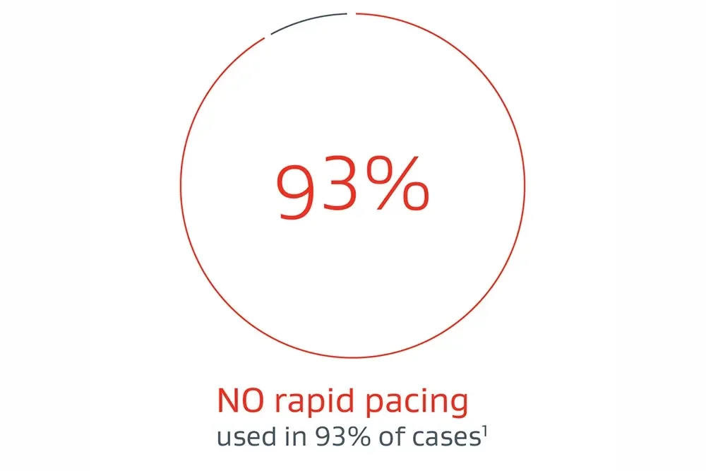 NO rapid pacing used in 93% of cases1