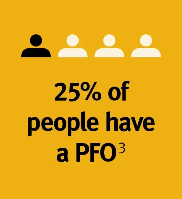 25% of people have a PFO
