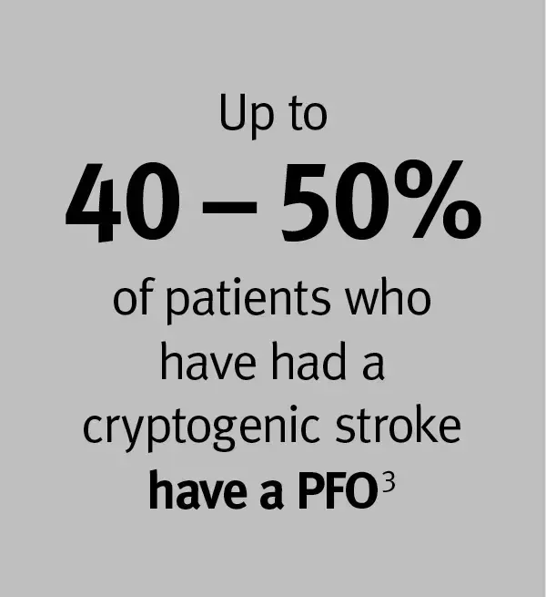Up to 40% - 50% of patients who have had a cryptogenic stroke have a PFO