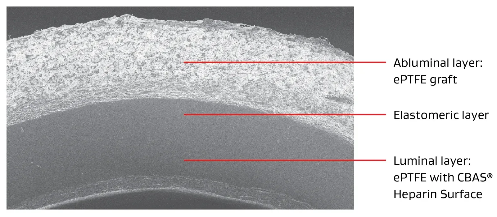Image showing the tri-layer design of the GORE ACUSEAL Vascular Graft. Abluminal layer (ePTFE graft). Elastomeric layer. Luminal layer (ePTFE with CBAS Heparin Surface).