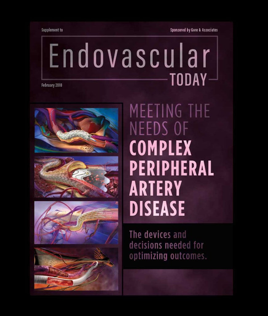 Meeting the needs of complex peripheral artery disease: The devices and decisions needed for optimizing outcomes - February 2018 EVT Supplement