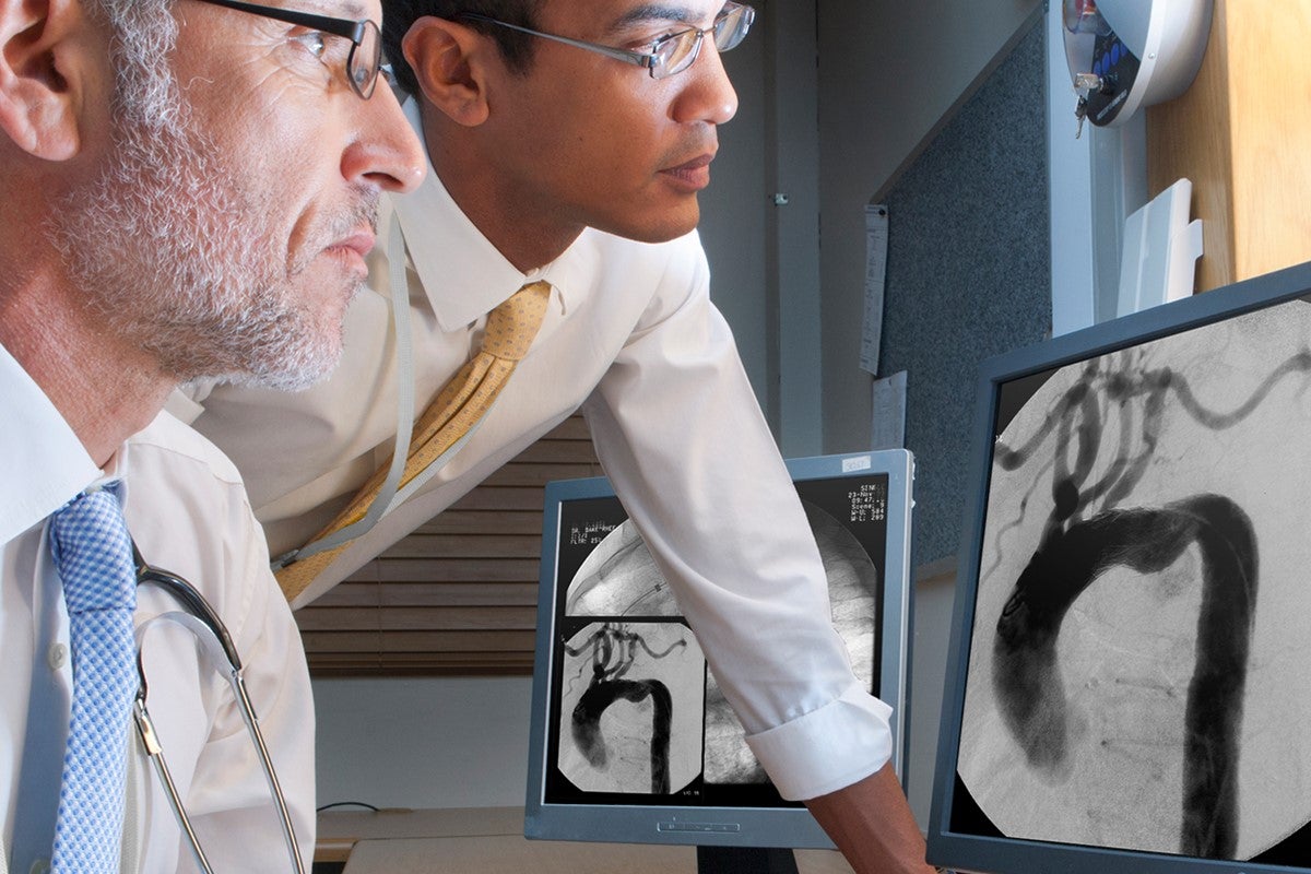 two doctors looking at angiogram