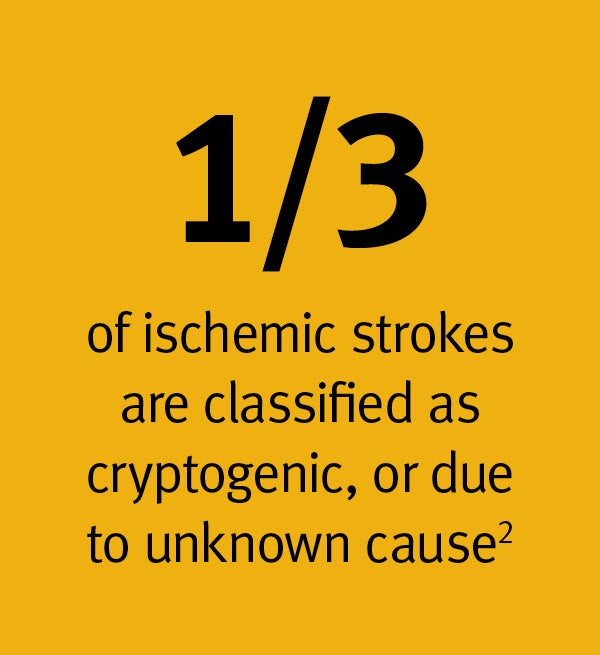1/3 of ischemic strokes are classified as cryptogenic, or due to unknown cause 2